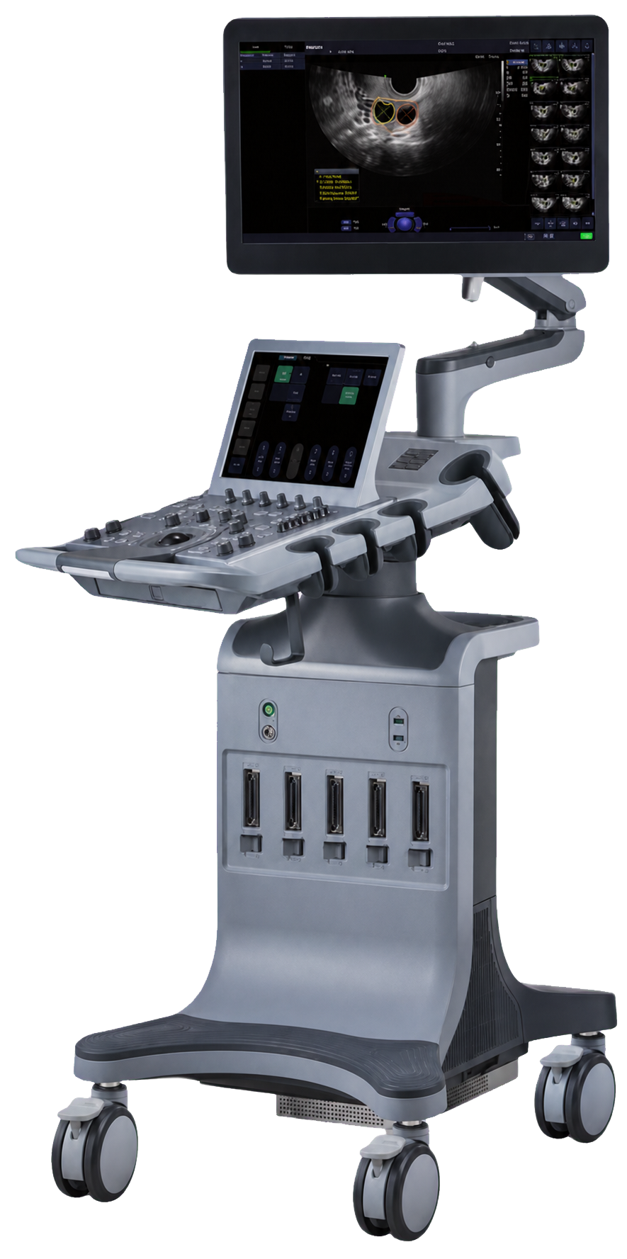 Cranial Ultrasound 2