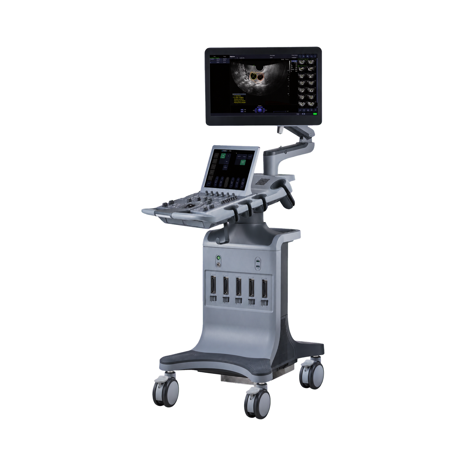 Cranial Ultrasound