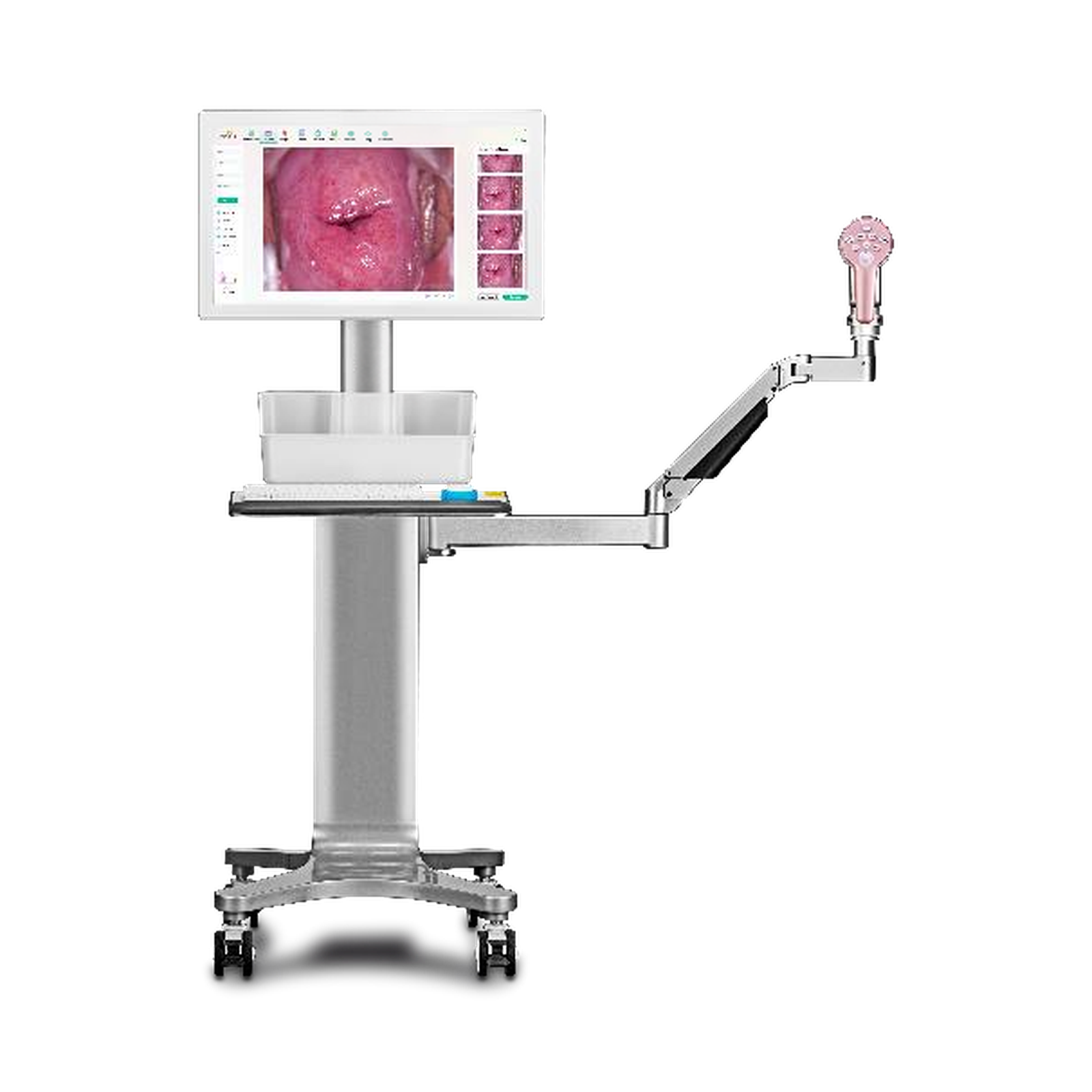 Colposcope